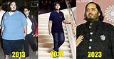 Anant Ambani's Health Update: a Comprehensive Analysis