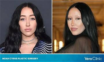 Fact Check: Is Noah Cyrus Asian? Before and After Photos -Everything on Her Mom and More
