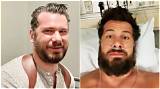 Unveiling Secrets of Steven Crowder's Surgery: Surprising Discoveries